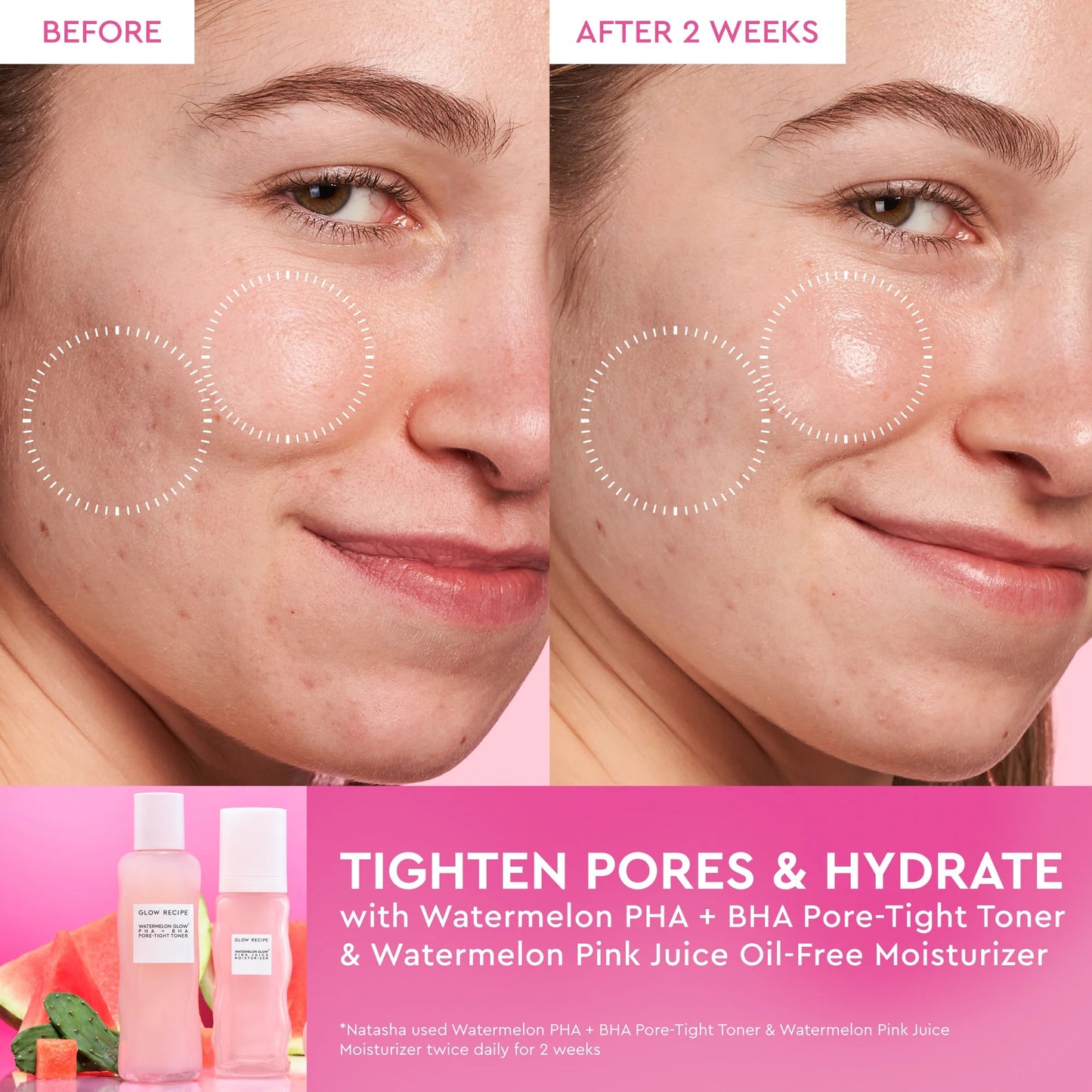 Watermelon Glow PHA+BHA Pore-Tight Toner(150ml)